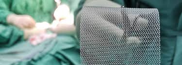 When Open Hernia Repair Is Still the Right Choice