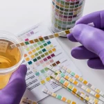 Essential Guide to Choosing the Right Urine Drug Test Kit