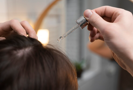 Find Out How Effective is Homeopathy Medicine for Hair Fall and Regrowth
