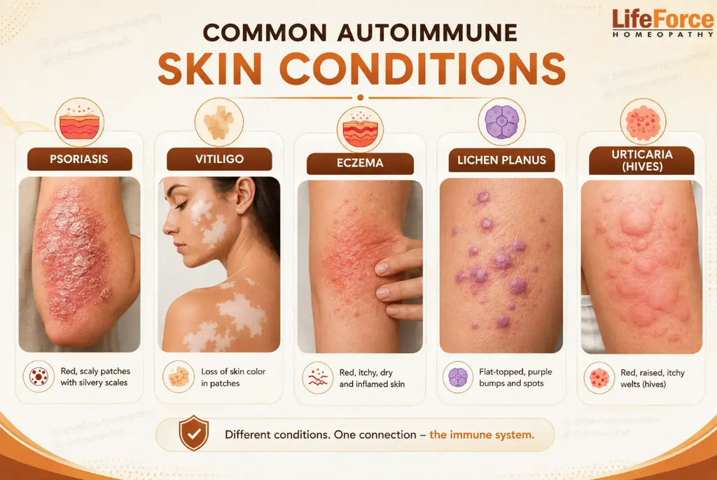 Medical illustration of psoriasis, vitiligo, eczema, lichen planus and urticaria